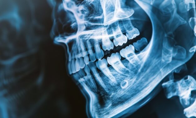 The Advancement of Biomaterials in Dental Restorations